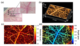 3D depth-coded photoacoustic microscopy with a large field of view for human skin imaging