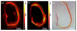 Photoacoustic characteristics of lipid-rich plaques under ultra-low temperature and formaldehyde treatment