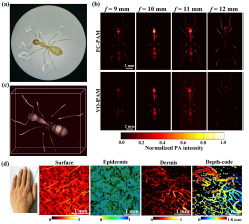 Fast controllable confocal focus photoacoustic microscopy using a synchronous zoom opto-sono objective