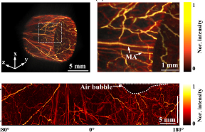 Large-depth-of-field optical-resolution colorectal photoacoustic endoscope