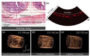 Shape-adapting panoramic photoacoustic endomicroscopy