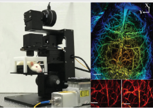 Wide-field monitoring and real-time local recording of microvascular networks on small animals with a dual-raster-scanned photoacoustic microscope