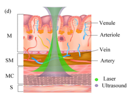 In vivo anatomical imaging of colorectum by tens-of-micron-resolved photoacoustic/ ultrasonic endoscope