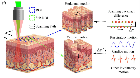 Subpixel and On-Line Motion Correction for Photoacoustic Dermoscopy