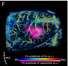 Photoacoustic-guided photothermal therapy by mapping of tumor microvasculature and nanoparticle