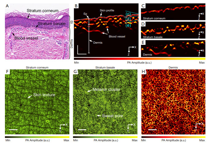 Quantitative multilayered assessment of skin lightening by photoacoustic microscopy