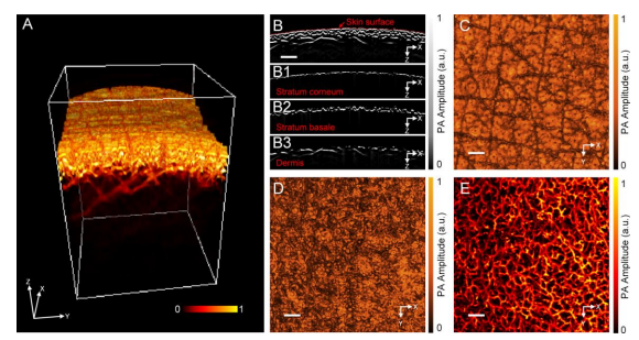 Quantitative and Anatomical Imaging of Human Skin by Noninvasive Photoacoustic Dermoscopy