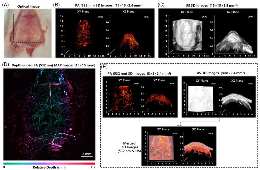 Photoacoustic (532 and 1064 nm) and ultrasonic coscanning microscopy for in vivo imaging on small animals: A productized strategy