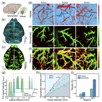 Monitoring the perivascular cerebrospinal fluid dynamics of the glymphatic pathway using co-localized photoacoustic microscopy