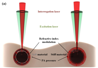 Photoacoustic remote sensing elastography