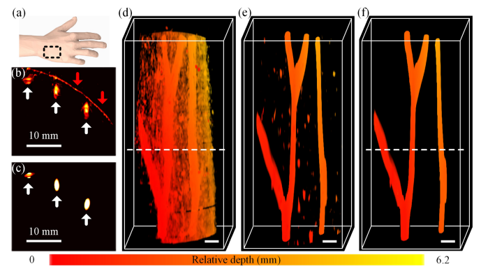 Optical-visualized photoacoustic tomographic navigation