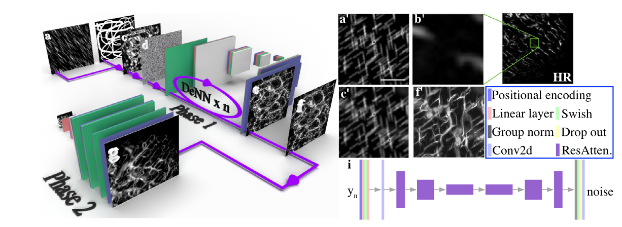 DOVE: Doodled vessel enhancement for photoacoustic angiography super resolution